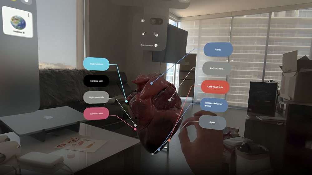 Scanomy – Anatomy Editor
